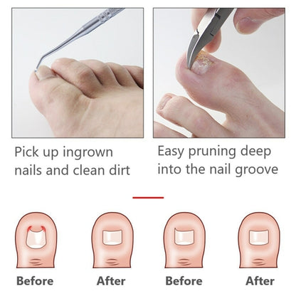 Dead Skin Dirt Remover Pedicure Care Tool