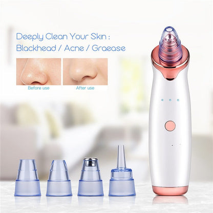 Vacuum Blackhead Remover Pimple Acne Removal Tool Skin Care Pore